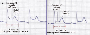 Figura 4.